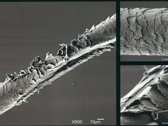 Волосы и кожа под микроскопом