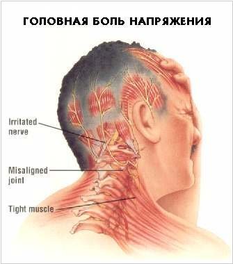 Как быстро снять напряжение в шее? Простой комплекс упражнений - Чемпионат